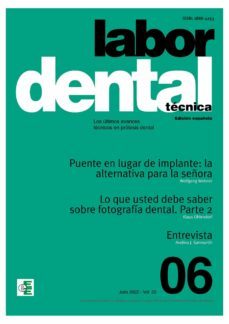 labor dental tecnica nº6 vol.25 (ebook)-9788412629002