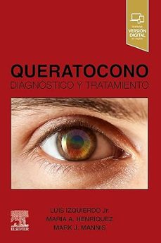 queratocono-9788413825502