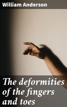 the deformities of the fingers and toes (ebook)-william anderson-4066339534612