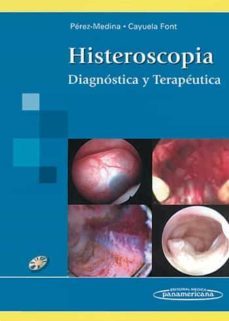 histeroscopia: diagnostica y terapeutica-tirso perez medina-enrique cayuela font-9789500682312