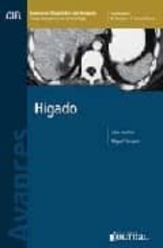 avances en diagnostico por imagenes 1: higado-miguel e. stoopen-9789871259212