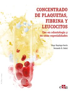 concentrado de plaquetas, fibrina y leucocitos. uso en odontologia y en otras especialidades-hugo esquiaga garcia-fernando orsini-9788418020322