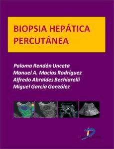 biopsia hepatica percutanea (ebook)-paloma rendon unceta-9788499697222