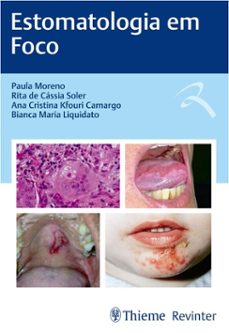 estomatologia em foco (ebook)-paula moreno-rita de cássia soler-ana cristina kfouri camargo-9786555723632