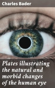 plates illustrating the natural and morbid changes of the human eye (ebook)-charles bader-4064066066642