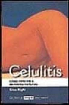 celulitis-gina righi-9788479010652