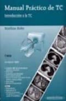 manual practico de tc, 5ª ed.-matthias hofer-9788479039752