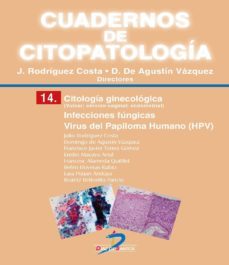 citologia ginecologica. infecciones fungicas. virus del papiloma humano (ebook)-julio rodriguez costa-domingo de agustin vazquez-9788490521052