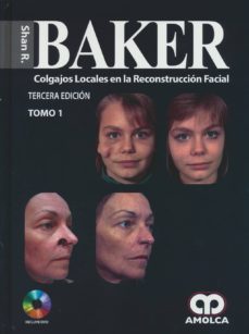 baker colgajos locales en la reconstruccion facial-9789588871752