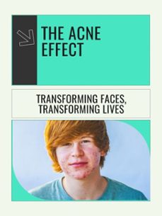 the acne effect (ebook)-scarlett y. turner-9781776838462