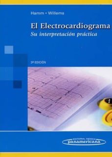 interpretación del electrocardiograma