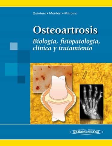 Osteoartrosis por Vv.aa.