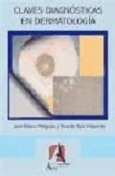 Descargar libro isbn numero CLAVES DIAGNOSTICAS EN DERMATOLOGIA PDB de JOSE BLASCO MELGUIZO, RICARDO RUIZ VILLAVERDE en español 9788495658692